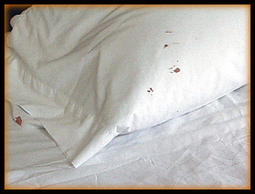 pictures of bed bugs on sheets