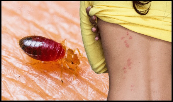 image of Bed Bug Bites on Skin