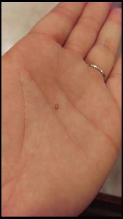Bed-Bug-Shell-in-hand