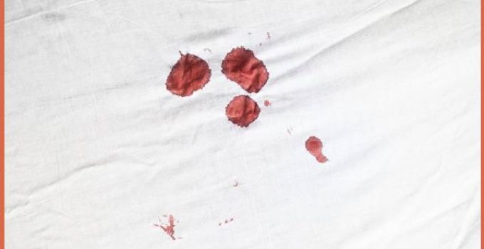 Blood on Sheets From Bed Bugs