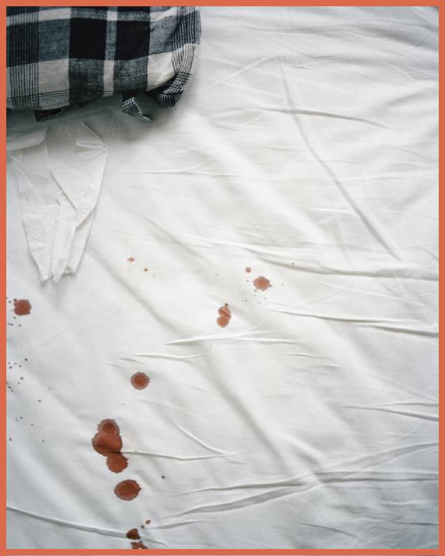 blood-stains-on-sheets